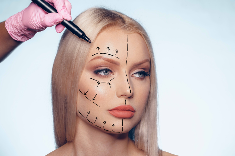 Facelift Surgery in Dubai