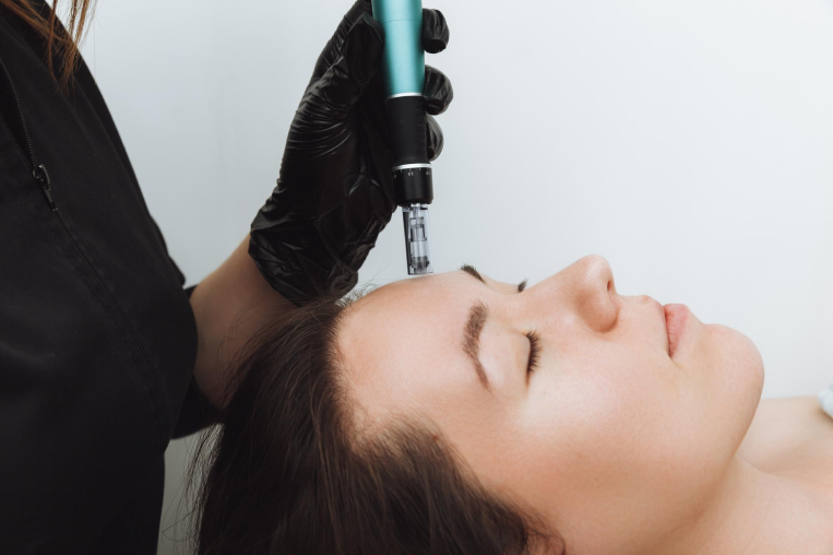 Microneedling in Dubai