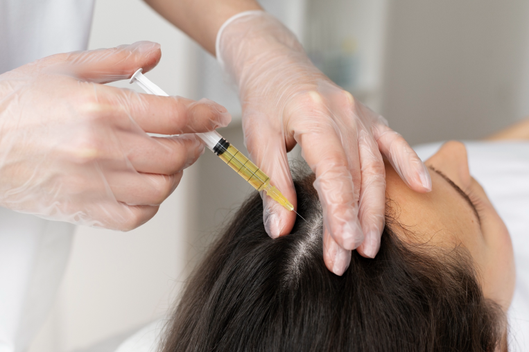 Exosomes Hair Treatment Dubai