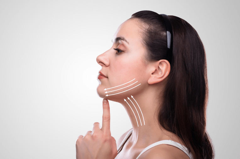 Jawline Contouring