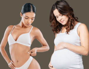 Pregnant after a tummy tuck