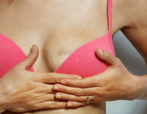 breast augmentation scars