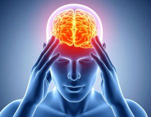 what is migraine headache