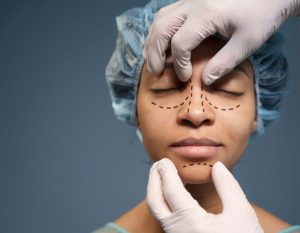 Rhinoplasty surgery by king's aesthetics