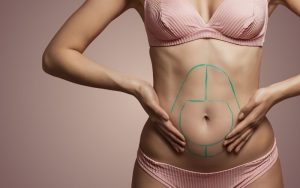 Types of Tummy Tucks - Aesthetics by king's